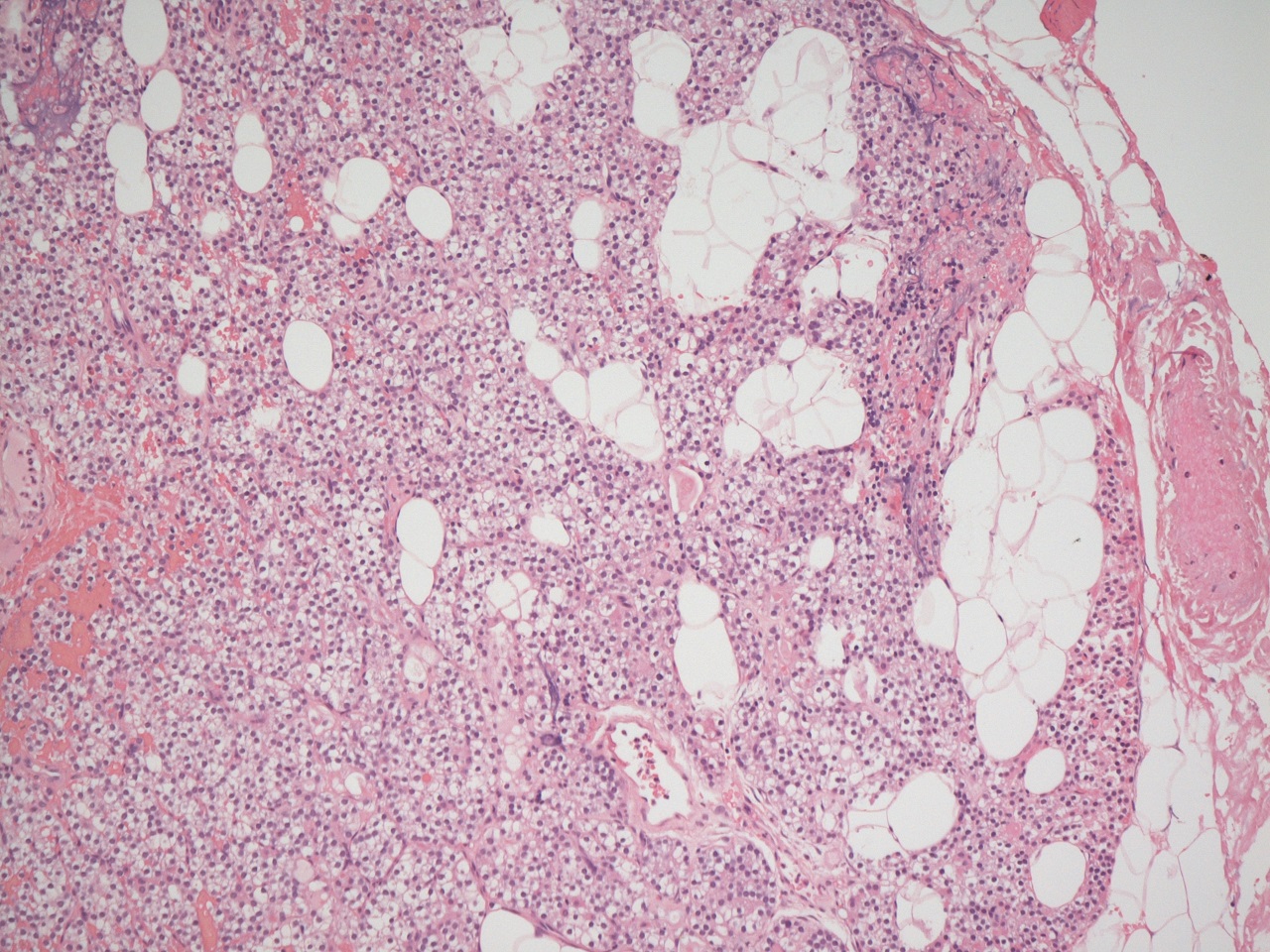 Histology of the parathyroid gland